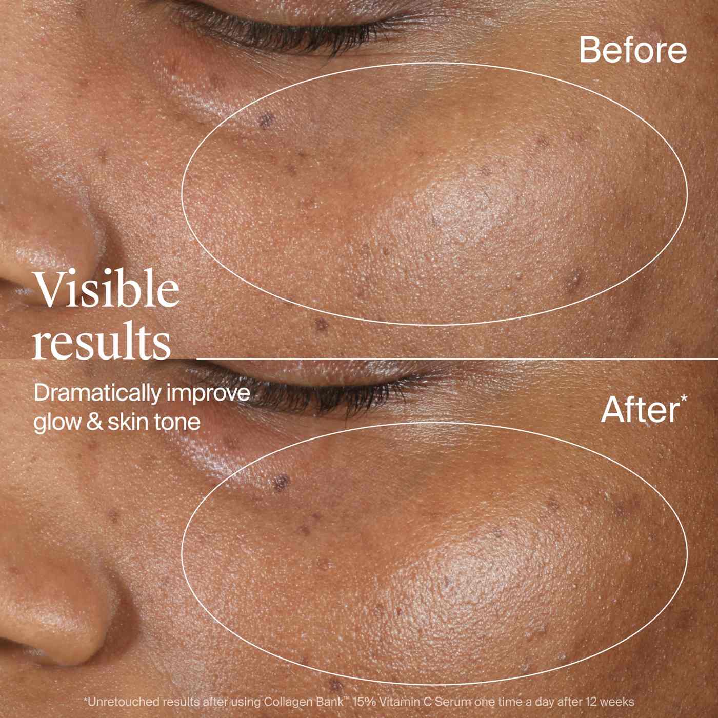 Neutrogena Collagen Bank 15% Vitamin C Booster Serum ; image 7 of 11