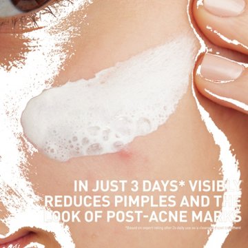 CeraVe Acne Clay to Foam Cleanser with 2% Salicylic Acid