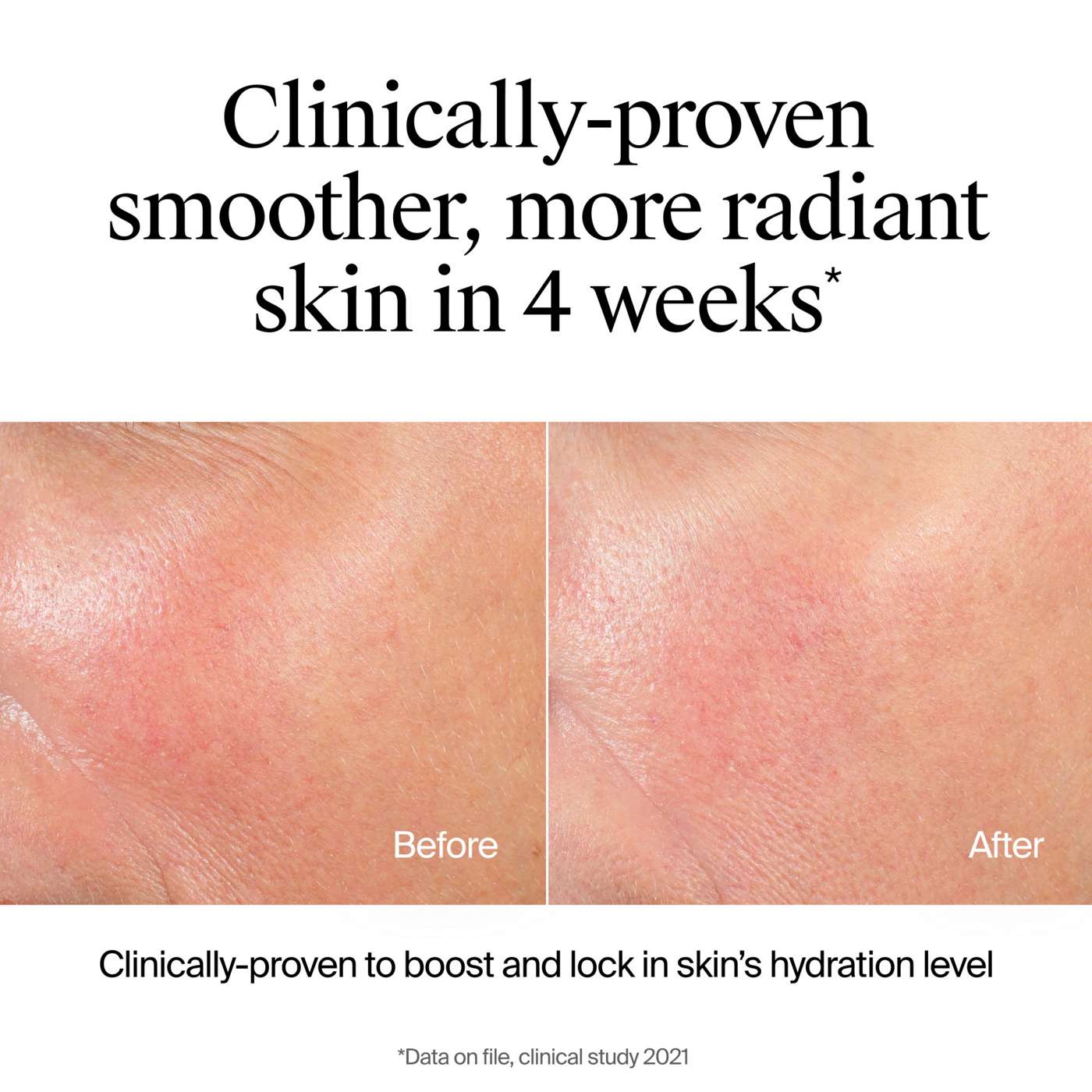 Neutrogena Hydro Boost Hydrating Gel Cleanser; image 19 of 19