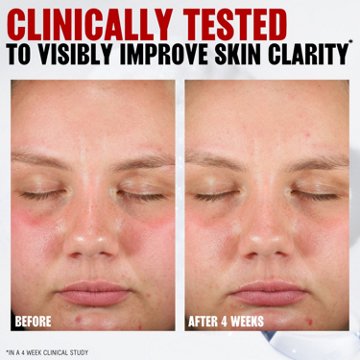 Thayers Pore Refining Pads