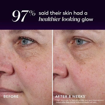 Olay Regenerist Glycolic Acid Night Peel, Exfoliating & Renewal Treatment, Lightweight Night Serum