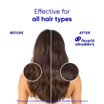 Head & Shoulders Dandruff Shampoo - Smooth & Silky