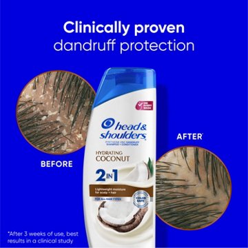 Head & Shoulders 2-in-1 Dandruff Shampoo & Conditioner - Hydrating Coconut