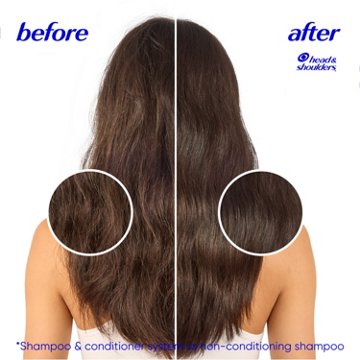 Head & Shoulders 2-in-1 Dandruff Shampoo & Conditioner - Smooth & Silky