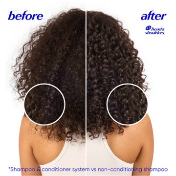 Head & Shoulders 2-in-1 Dandruff Shampoo & Conditioner - Smooth & Silky
