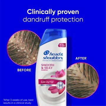 Head & Shoulders Dandruff Conditioner - Smooth & Silky
