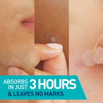 CeraVe Blemish Barrier Patches
